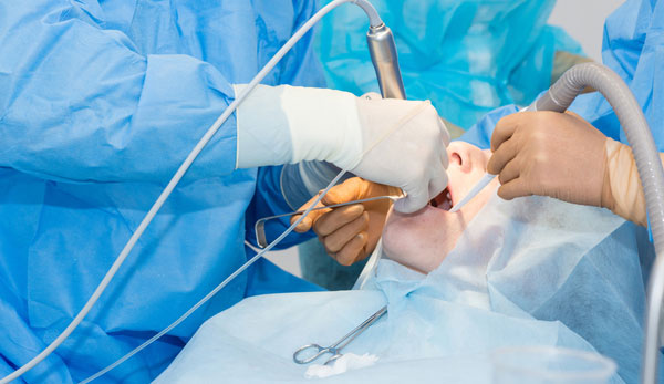 Auckland's Trusted IV Sedation Dentist: Safe and Effective Care - QCD