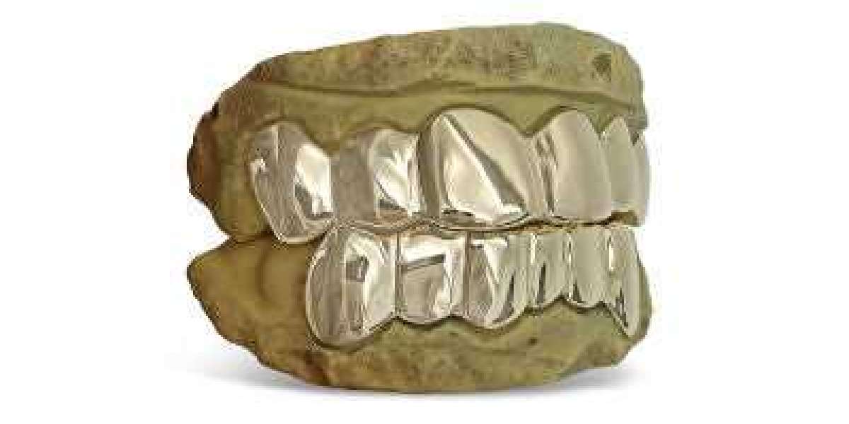 Who Should Buy Grillz for Teeth in Las Vegas?