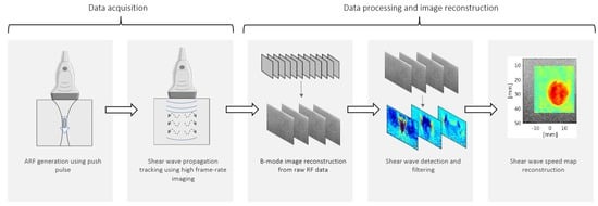 Shear Wave Research System: Best Research Ultrasound System