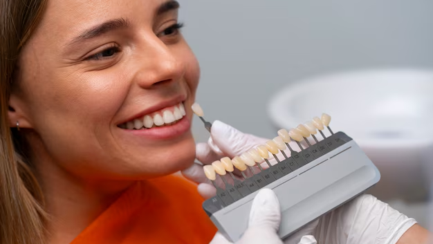 Being Familiar About the Process of Dental Veneers in Ottawa, Canada